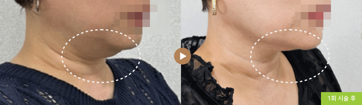 컨텐츠 이미지