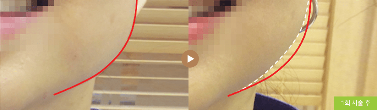컨텐츠 이미지