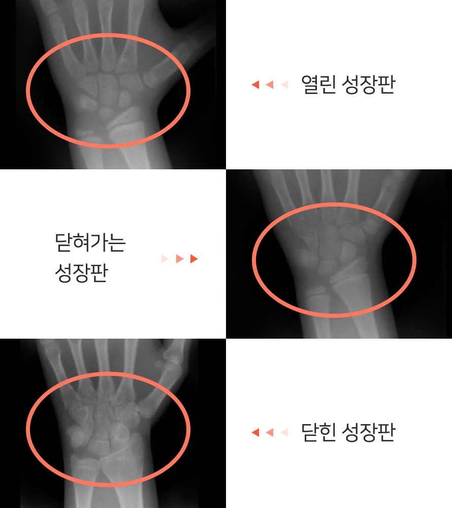 컨텐츠 이미지